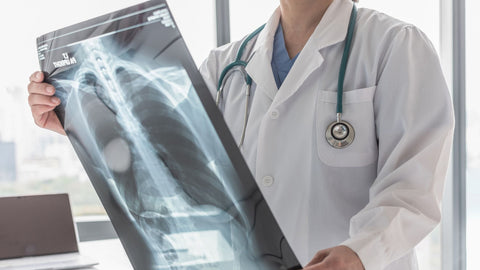 Bone Health: Essential Nutrients for Strong Bones